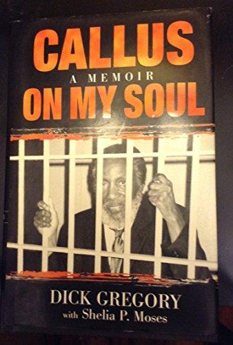 Callus on My Soul: A Memoir Cover