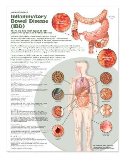 Understanding Inflammatory Bowel Disease (IBD) Anatomical Chart Cover
