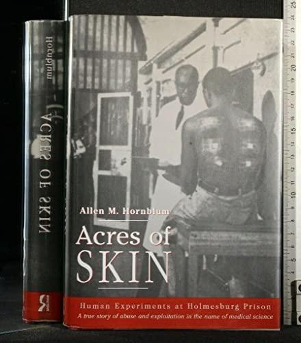 Acres of Skin: Human Experiments at Holmesburg Prison Cover